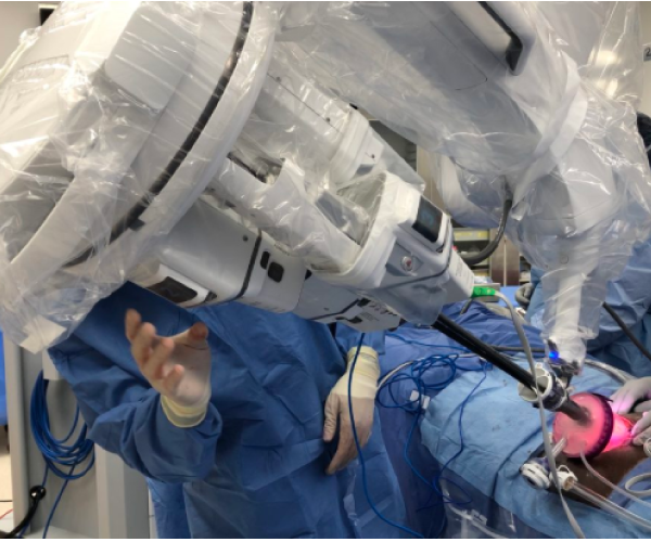 Cleveland Clinic es la primera en el mundo en realizar un trasplante de riñón por sistema robótico de puerto único